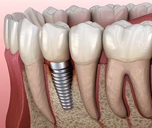 Patient talking with his dental team